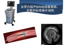 内置马达式血管内超声(IVUS)探头的设计与研制-器械之心