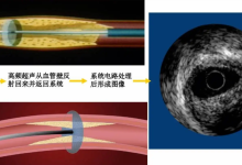血管内超声诊断设备性能测试研究-器械之心